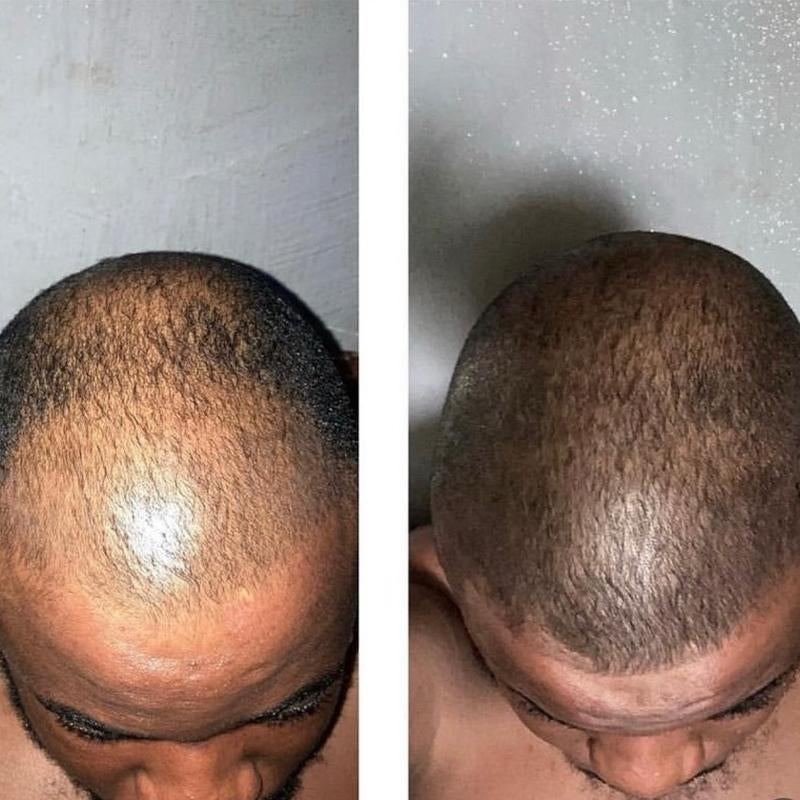 Beard Growth Oil, Rapid Beard Thickening, Plant Based Beard Growth Oil, Men Beard Care