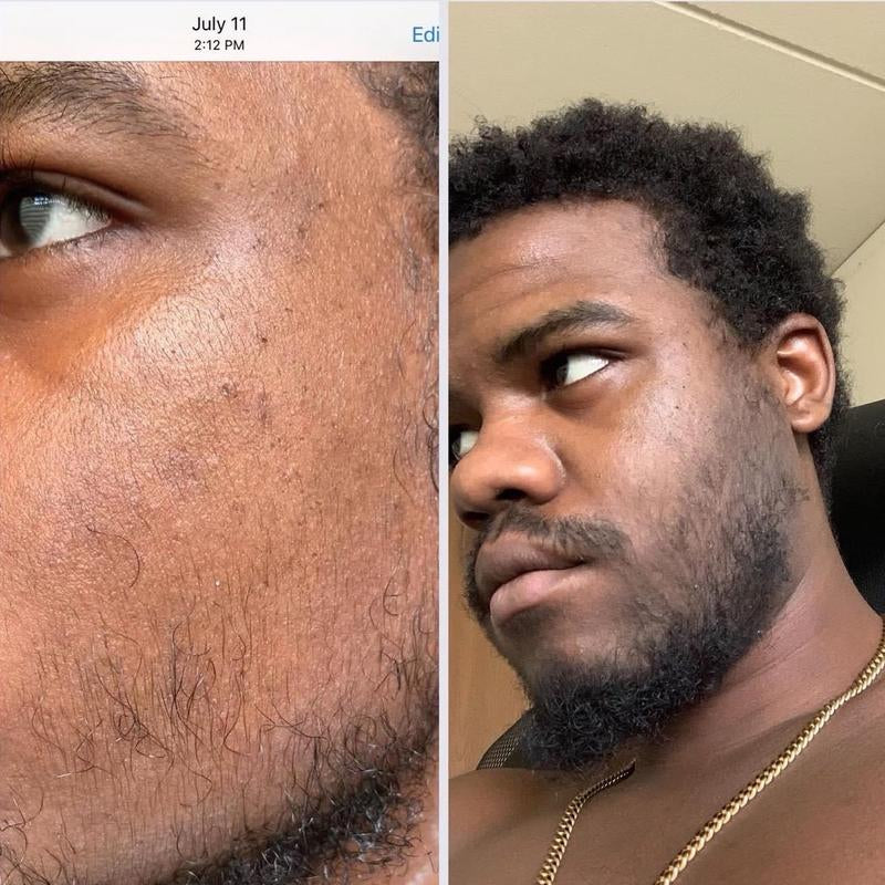 Beard Growth Oil, Rapid Beard Thickening, Plant Based Beard Growth Oil, Men Beard Care